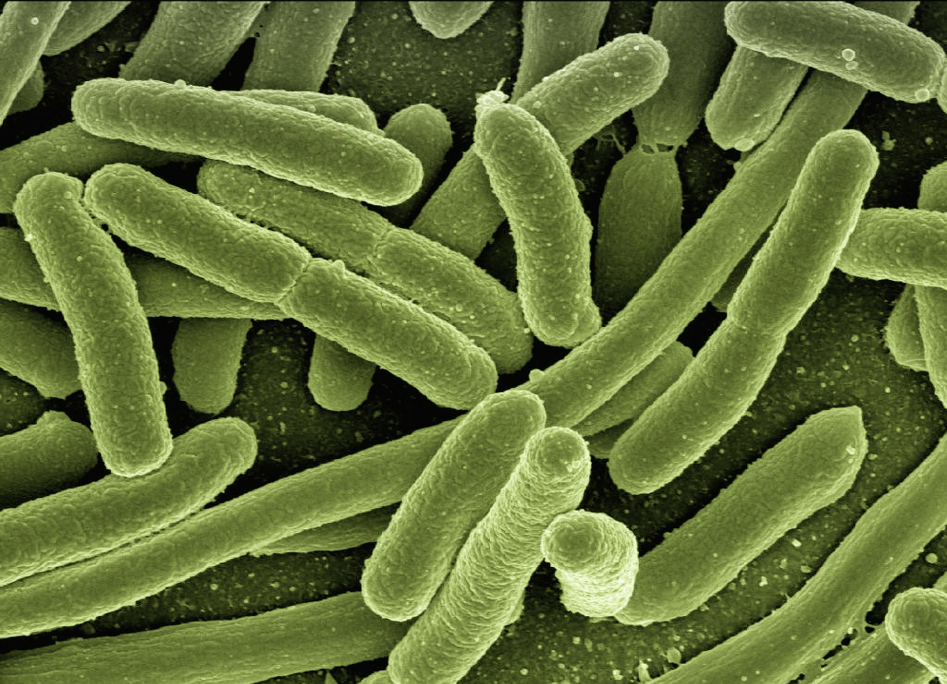 koli bacteria 1230811920