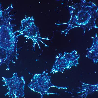 방사선 치료: 암세포의 단백질 복구 매커니즘에 대한 연구