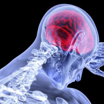 뇌졸중: 신경 반응을 통한 손상 예방에 관한 연구